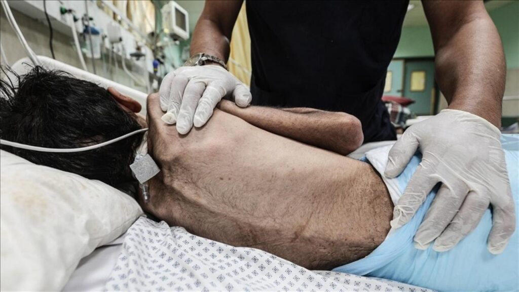 Gazze’de açlıktan ölenlerin sayısı 404’e yükseldi